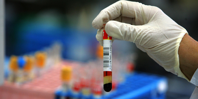 Blood test checks cancer cures