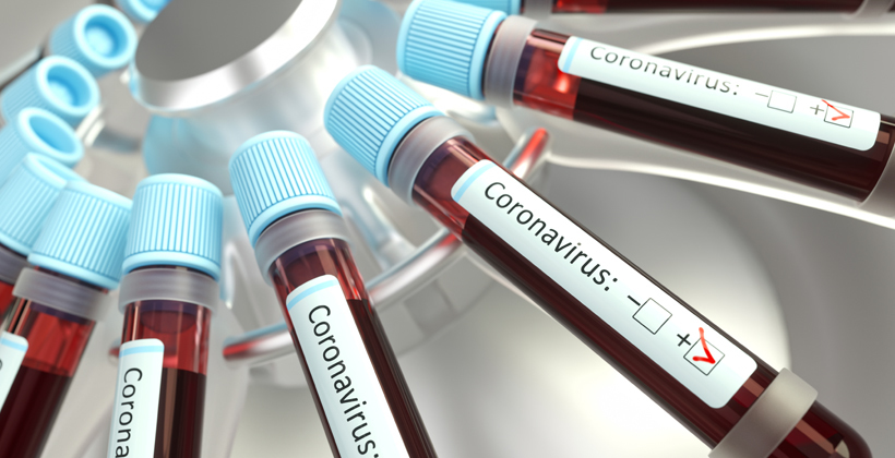 Weekend test lull lowers new COVID-19 cases