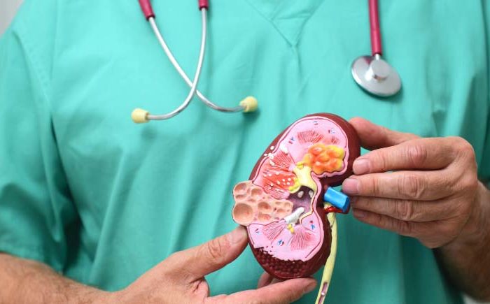 Māori miss out on kidney treatment