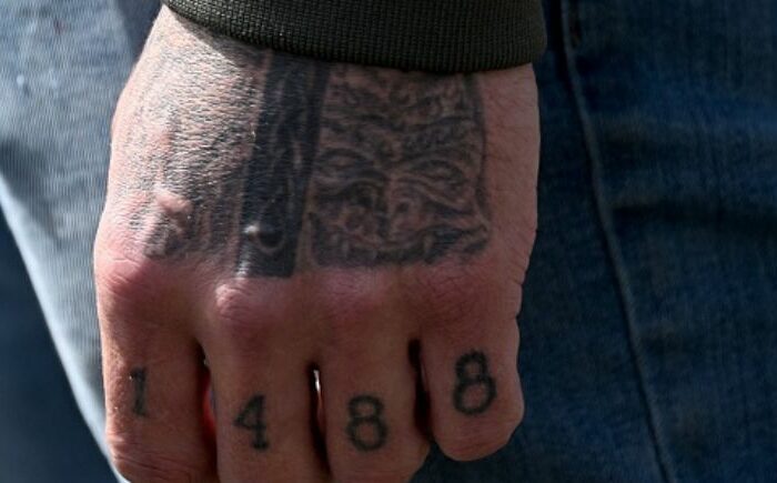 Racist tattoo removal a chance for change